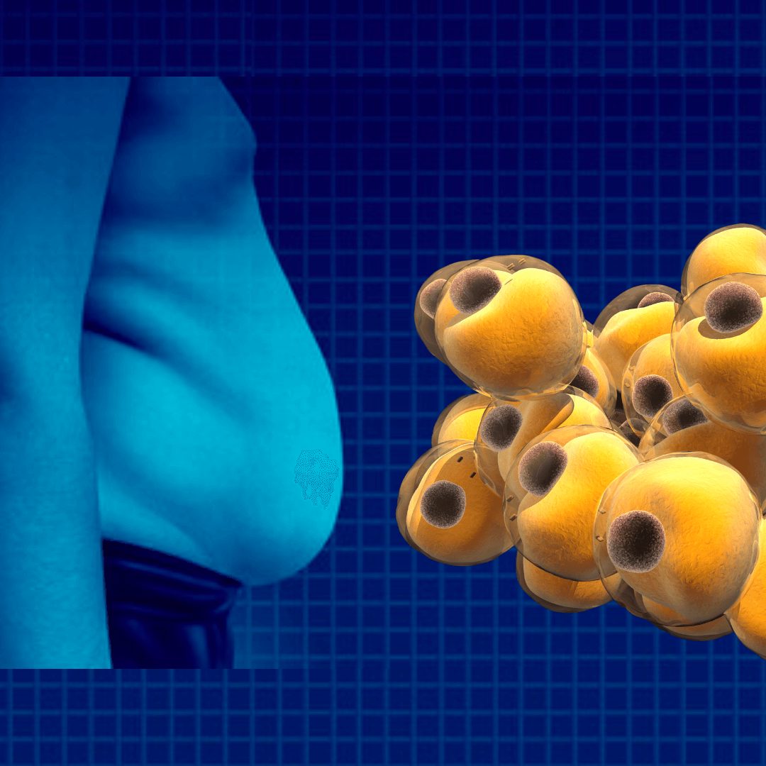 Overweight man's stomach with illustration of fat cells